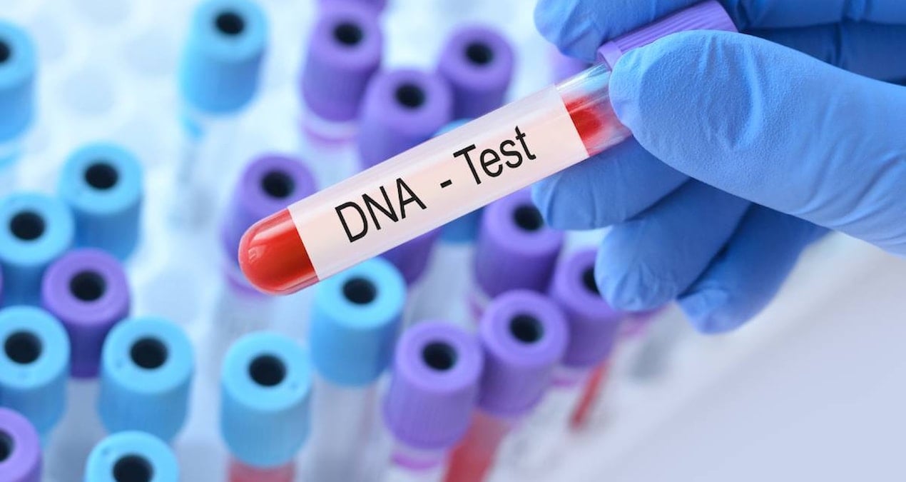 Eğlence İçin Yapılan DNA Testi: Korkunç Aile Gerçeği Ortaya Çıktı